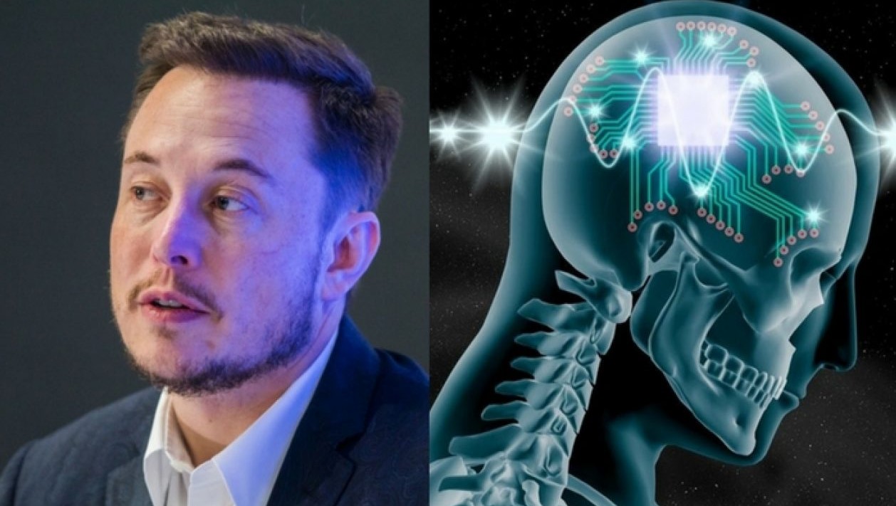 How Much Will Neuralink Cost? Full Review - Elon Musk - Rang Riwaj